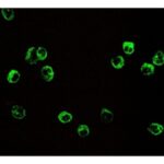 A Unusual Presentation of Wegener’s Granulomatosis Revealing Perinuclear Antineutrophil Cytoplasmic Antibody Positivity