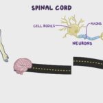 Insights on Spinal Cord Strokes and Prostate Management