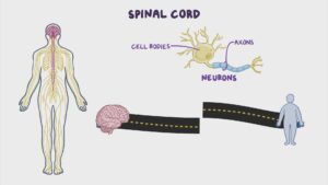 Insights on Spinal Cord Strokes and Prostate Management